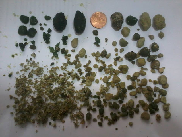 andreas moritz limpieza hepatica